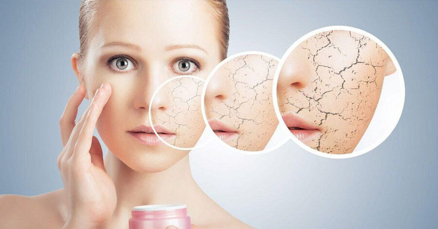 Protege tu piel del frío