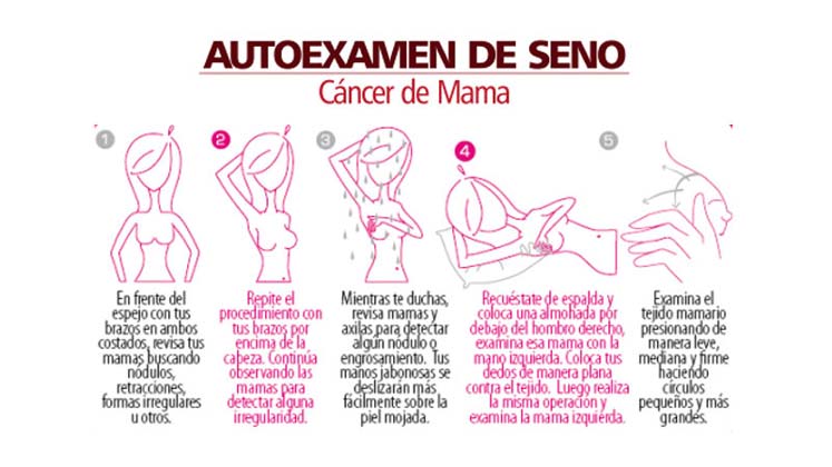 autoexamen de mamas 2017