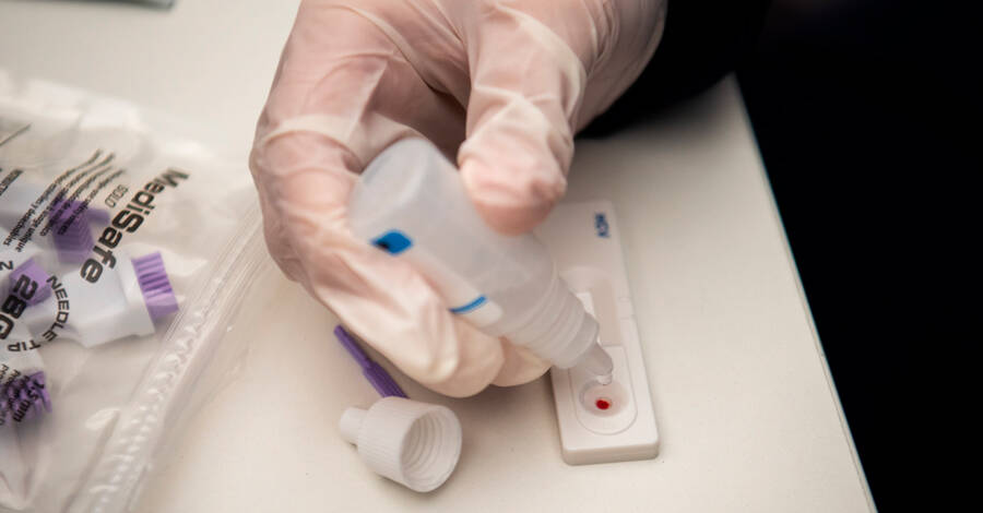 test de hepatitis c
